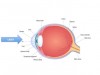 Fig 1. Ophthalmic surgery: diode lasers are placed uninitiated, out of contact of the eyeball to perform retinal surgery.